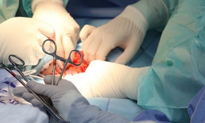 Ligamentotomie – Operation zur Penisvergrößerung