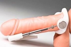 Extender zur Penisvergrößerung